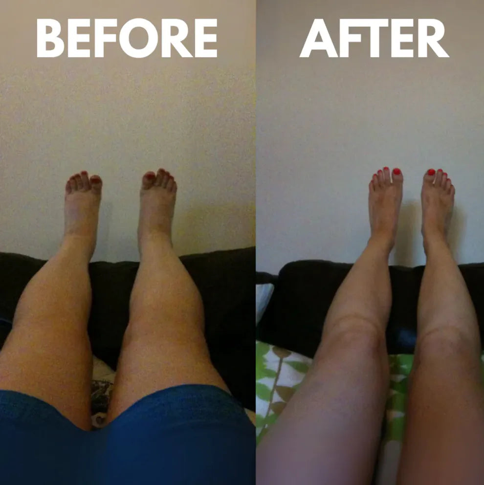 🔥HOT SALE-49% OFF🔥+🔥FREESHIPPING🔥 Movea Calf Massager with Heat